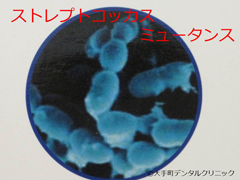 虫歯菌のミュータンス菌